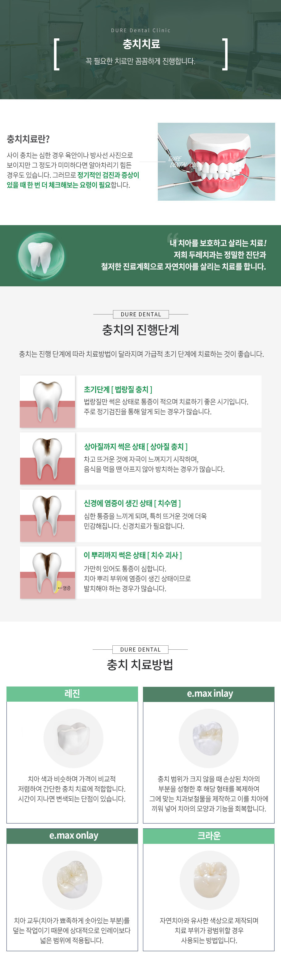 충치치료