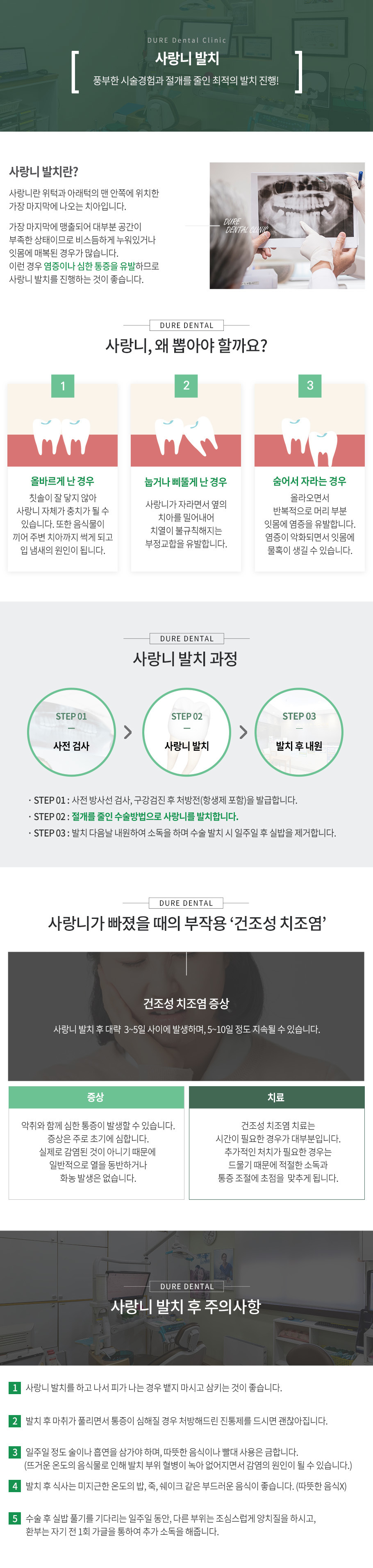 사랑니발치