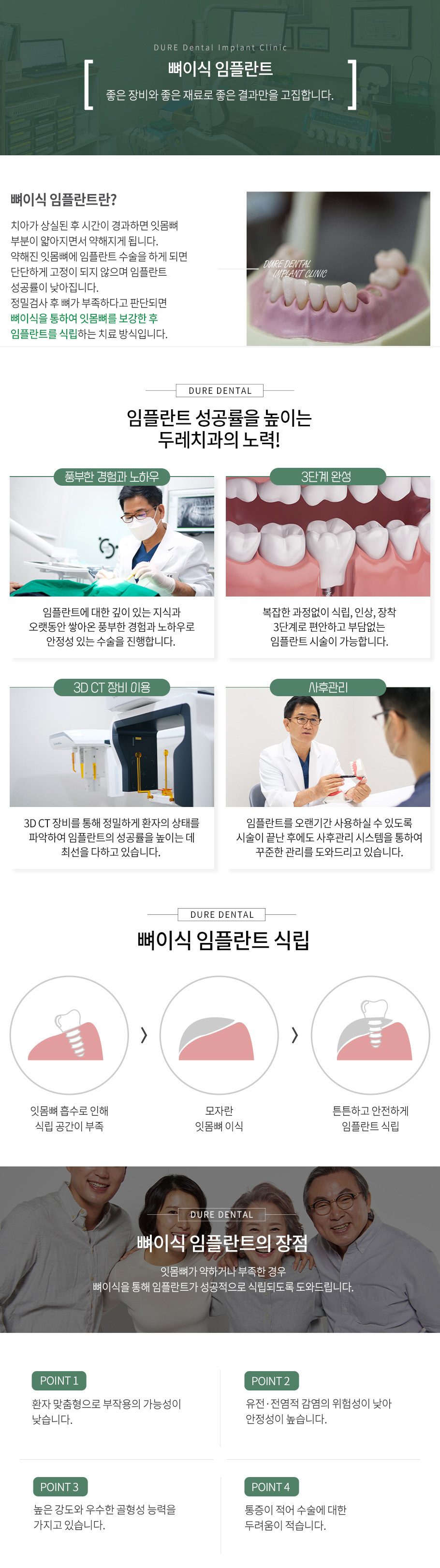 뼈이식 임플란트