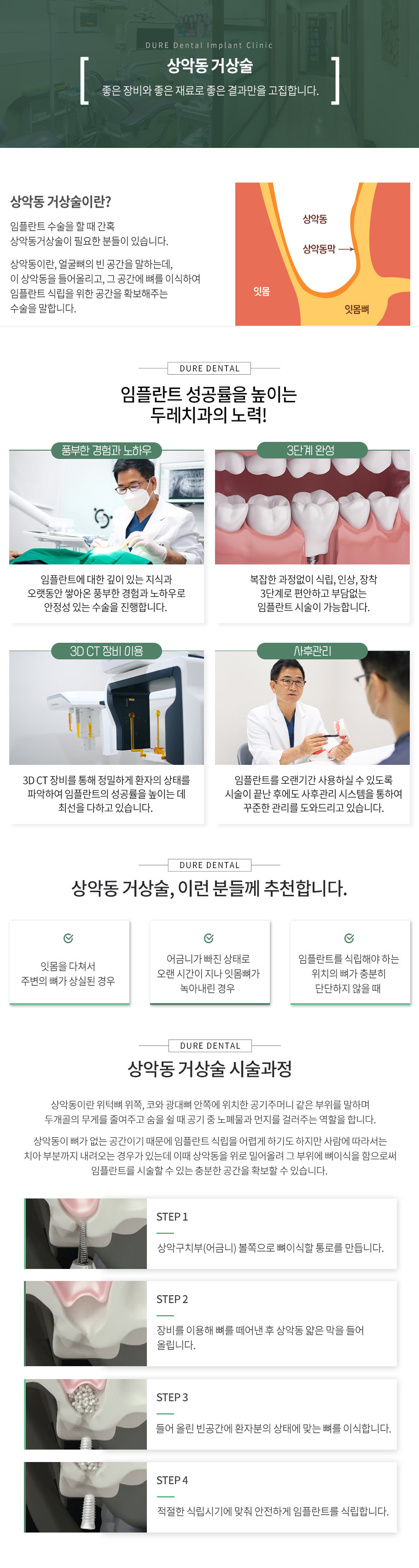 상악동거상술